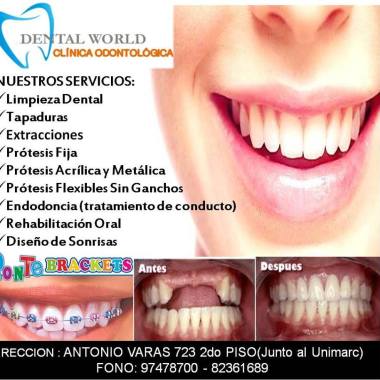 Clinica  Dental  Rodxon Andrade Bolaños   (Dental World )