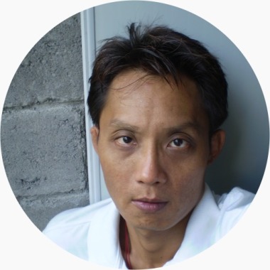 Google Heintje Aryadi Jogja Agiong Yogyakarta Yance Lasso JL Monjali no 30C Gang Intan Nandan Sleman Tempat Pengobatan Sakit Lupus SLE Systemic Lupus Erythematosus di Indonesia