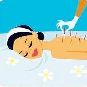 Acupunctura