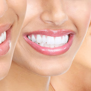 ODONTOSORRISO