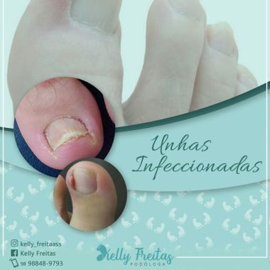 Oficina das unhas