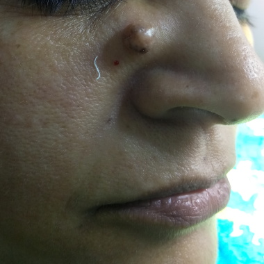 Plastic and cosmetic surgery