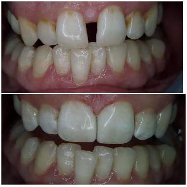 Clinica dental Laserdent  Plus