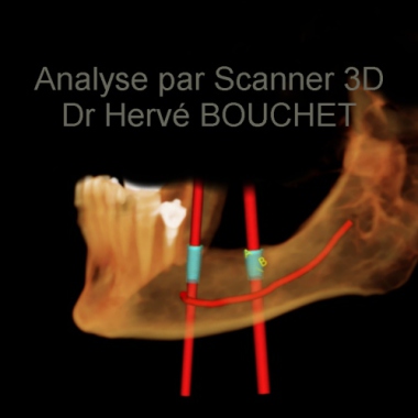 Cabinet d'implantologie dentaire Dr BOUCHET