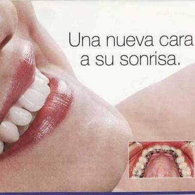 E-LINE - Ortodoncia Invisible