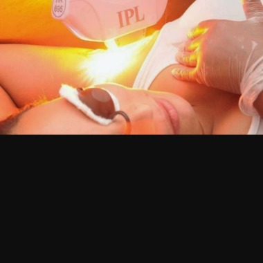 TRADERMA