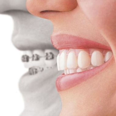 Buderim Dental Care