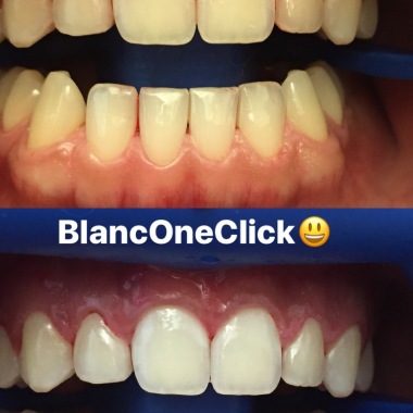 Igienista Dentale