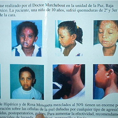 Consultorio genera,  Medicina Regenerativa, Medicina Estetica
