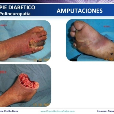 Podologia  Clinica