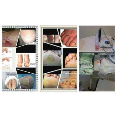 Servicio integral Podologia Clinica