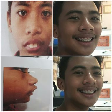Dr. Racquel  Manalansan -Sitjar  Dental Clinic