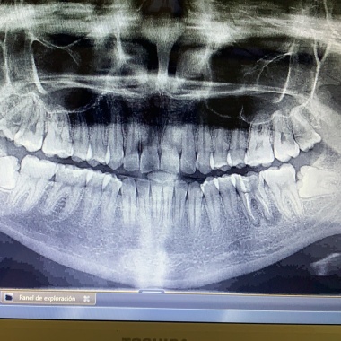Dental CaFi