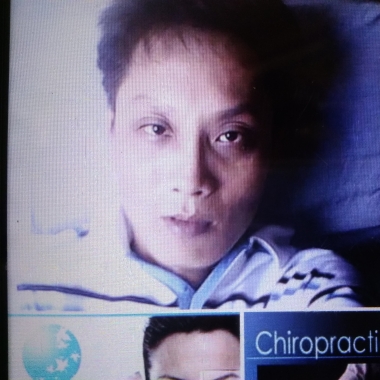Akupunktur Indonesia Yance Lasso Surabaya Ahli Chiropractic Indonesia